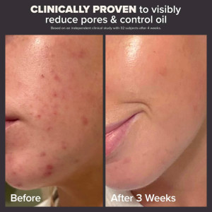 Отшелушивающий тоник для лица Paula's Choice  Skin Perfecting 2% BHA Exfoliating Toner for Clear Skin - 30 ml