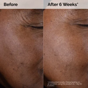 Тоник The Ordinary Glycolic Acid 7% Exfoliating Toner 100ml