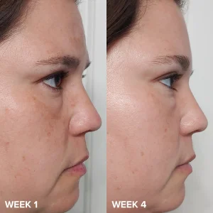 Paula's Choice Skin Perfecting 2% BHA Liquid Exfoliant 118ml tonigi