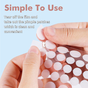 Пластыри от прыщей Pimple Patches for Face - 304штук