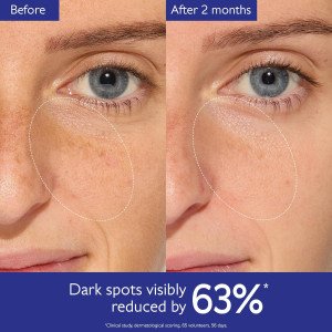 Caudalie Vinoperfect Dark Spot Brightening Serum - 30 мл pigment dog'lariga qarshi oqartiruvchi sivorotka