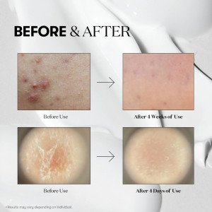 Бустер-сыворотка с микроиглами VT cosmetics Reedle Shot 100 - 50мл