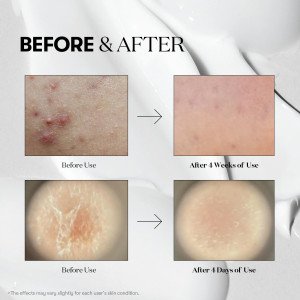 Бустер-сыворотка с микроиглами VT cosmetics Reedle Shot 300 - 50мл
