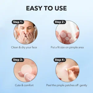 Гидроколлоидные пластыри от прыщей QUSTERE Pimple Patches - 288 шт