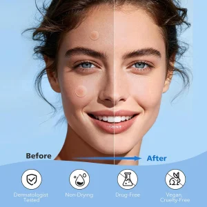 Гидроколлоидные пластыри от прыщей QUSTERE Pimple Patches - 288 шт