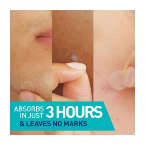 Гидроколлоидные патчи от прыщей CeraVe Blemish Barrier Patches - 44 шт