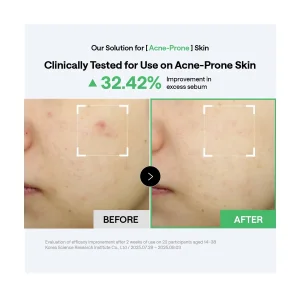 Успокаивающие тонер-пэды MEDIHEAL Teatree Trouble Calming Pad - 100 шт