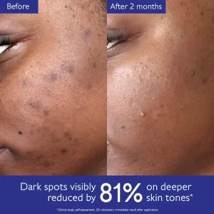 Осветляющая сыворотка против пигментных пятен Caudalie Vinoperfect Dark Spot Brightening Serum - 50 мл
