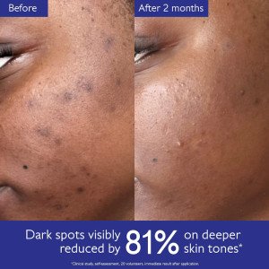 Caudalie Vinoperfect Dark Spot Brightening Serum - 30 мл pigment dog'lariga qarshi oqartiruvchi sivorotka