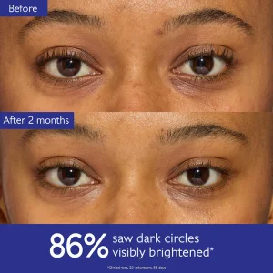 Ko'z atrofi uchun yorqinlashtiruvchi Caudalie Vinoperfect Brightening Eye Cream kremi, 15 ml
