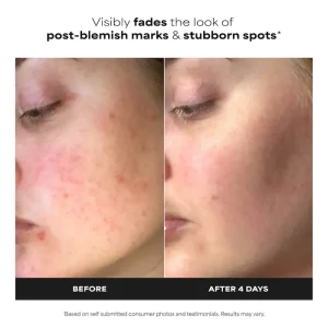 Бустер против покраснений Paula's Choice 10% Azelaic Acid BOOSTER for Redness Relief - 30 ml
