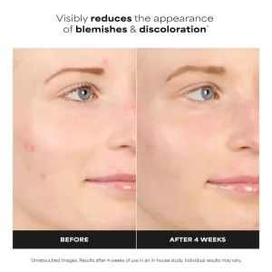 Бустер против покраснений Paula's Choice 10% Azelaic Acid BOOSTER for Redness Relief - 30 ml