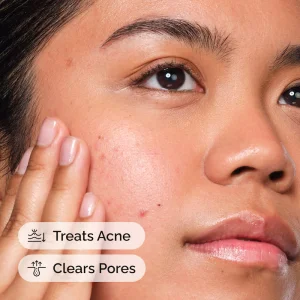 The Ordinary Salicylic Acid 2% Solution, Exfoliating Serum for Acne - 30 ml aknega qarshi eksfoliatsiya qiluvchi sivorotka