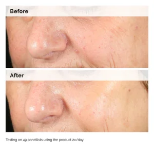 Сыворотка от пигментации The Ordinary Alpha Arbutin 2% + Hyaluronic Acid for Hyperpigmentation - 60 ml