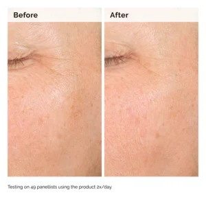 Сыворотка от пигментации The Ordinary Alpha Arbutin 2% + Hyaluronic Acid for Hyperpigmentation - 60 ml
