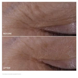 Двухфазная антивозрастная сыворотка для вокруг глаз Clarins Double Serum® Eye Brightening & Depuffing Anti-Aging Concentrate - 20 ml